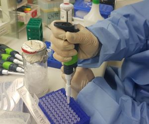 Exame para identificar vírus Zika é comercializado no país