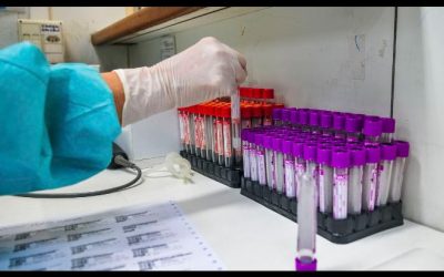 Coronavírus: UFRJ desenvolve teste sorológico 20 vezes mais barato