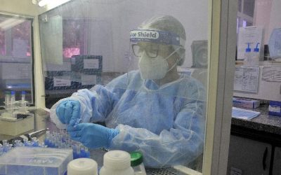 Estrutura do Lacen foi essencial para mapear Covid-19 no Estado, avalia OMS