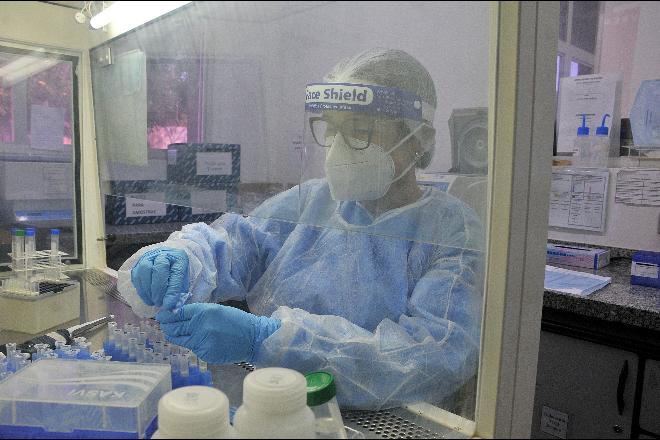 Estrutura do Lacen foi essencial para mapear Covid-19 no Estado, avalia OMS